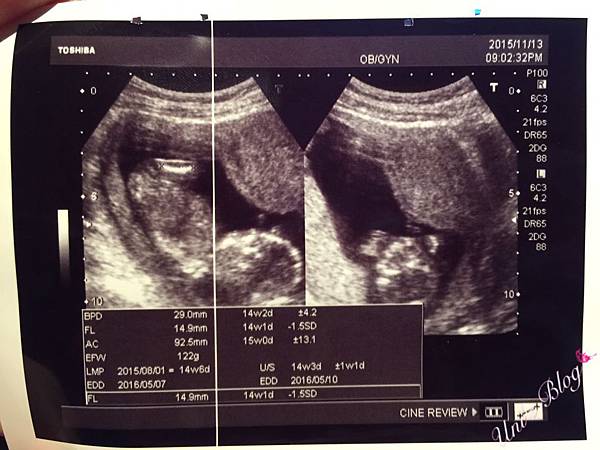 S__38043651 S__38043651