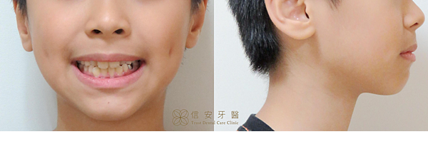 1(矯正前).png 1(矯正前).png