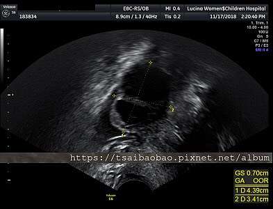 18 11 17 11 24 第二 三次回診 蔡胎芽登場 曼曼生活 Mannilife 痞客邦