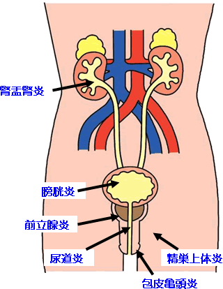 疑似急性腎盂腎炎引發的腰痛 淡水小鎮張晉豪中醫師部落格 痞客邦 疑似急性腎盂腎炎引發的腰痛 淡水小鎮張晉豪中醫師部落格 痞客邦