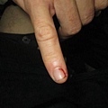 thumb