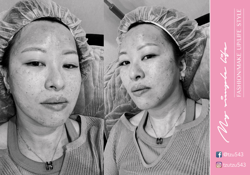 滋滋＜爱保养＞首次尝试就惊艳的水光疗程-永欣诊所