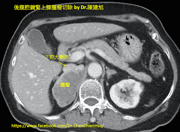 螢幕快照 2019-01-09 16.54.59.png 螢幕快照 2019-01-09 16.54.59.png
