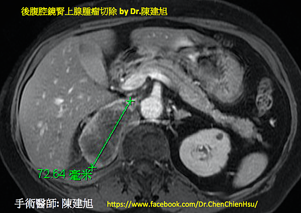 螢幕快照 2019-01-09 16.55.28.png 螢幕快照 2019-01-09 16.55.28.png