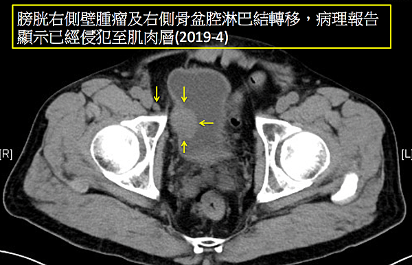 螢幕快照 2020-04-03 13.37.56.png