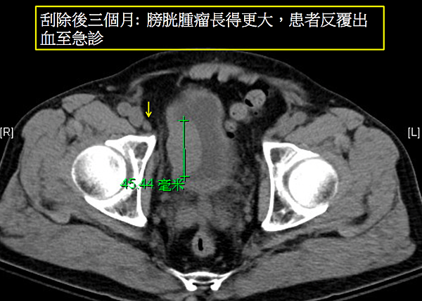 螢幕快照 2020-04-03 13.38.20.png