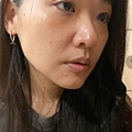 LINE_ALBUM_DR. LAI 美邑來_230822_1.jpg