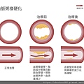 動脈硬化-01.jpg