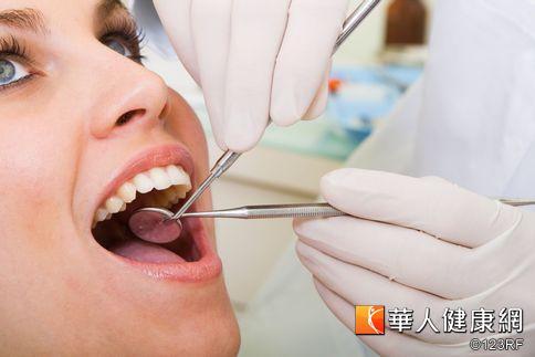 防牙周病　洗牙和口腔定檢不可少