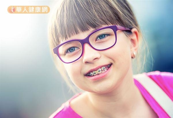 兒童暴牙別煩惱!生理性顱顏齒顎矯正改善((新聞分享)) 兒童暴牙別煩惱!生理性顱顏齒顎矯正改善((新聞分享))