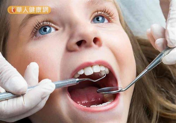 兒童咬合不正做牙齒矯正 戒掉吸吮大拇指不良習慣2 兒童咬合不正做牙齒矯正 戒掉吸吮大拇指不良習慣2