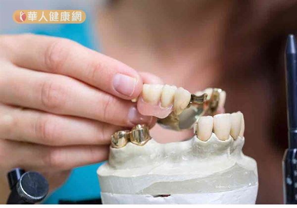 銀髮族笑口常開秘密:從齒顎矯正開始,關鍵在…2 銀髮族笑口常開秘密:從齒顎矯正開始,關鍵在…2