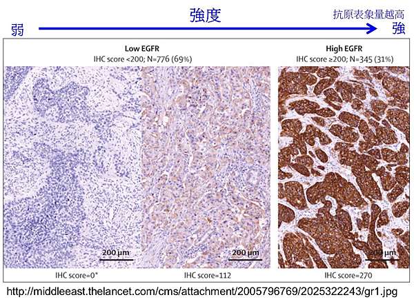 簡介組織免疫染色原理 Immunohistochemistry Ihc 基因叔叔 科普 期刊導讀 Uncle Gene 痞客邦