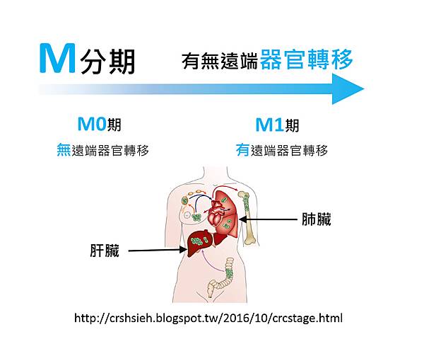 腸癌分期診斷-3.tif