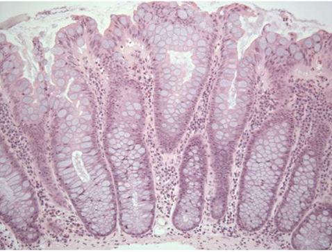 colon-GCHP.tif