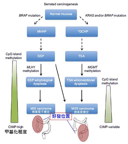 colon-SP progression.tif