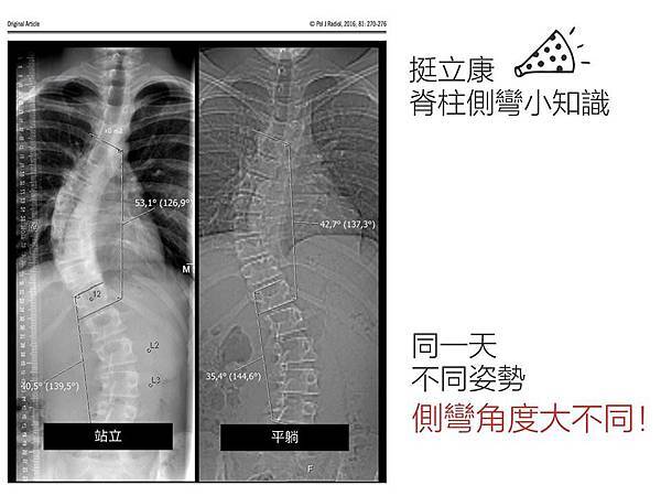 xray.jpg xray.jpg