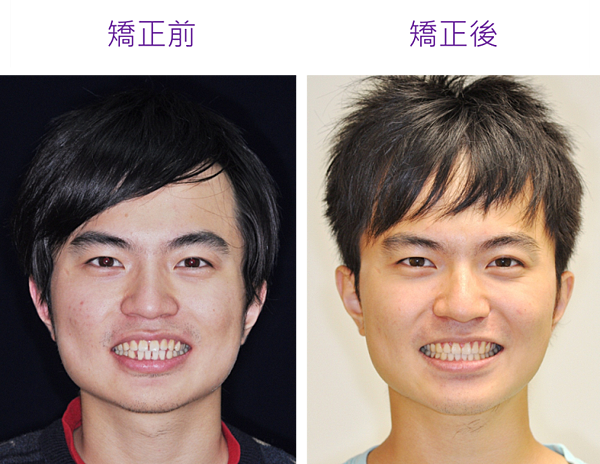 圖片1 圖片1