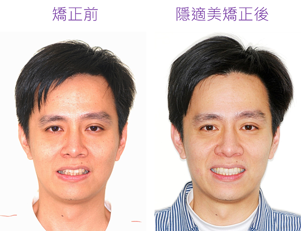 圖片1 圖片1