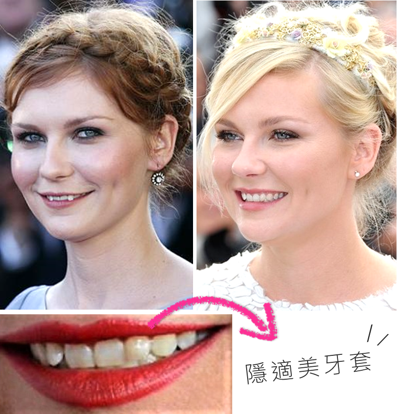Dunst.png Dunst.png