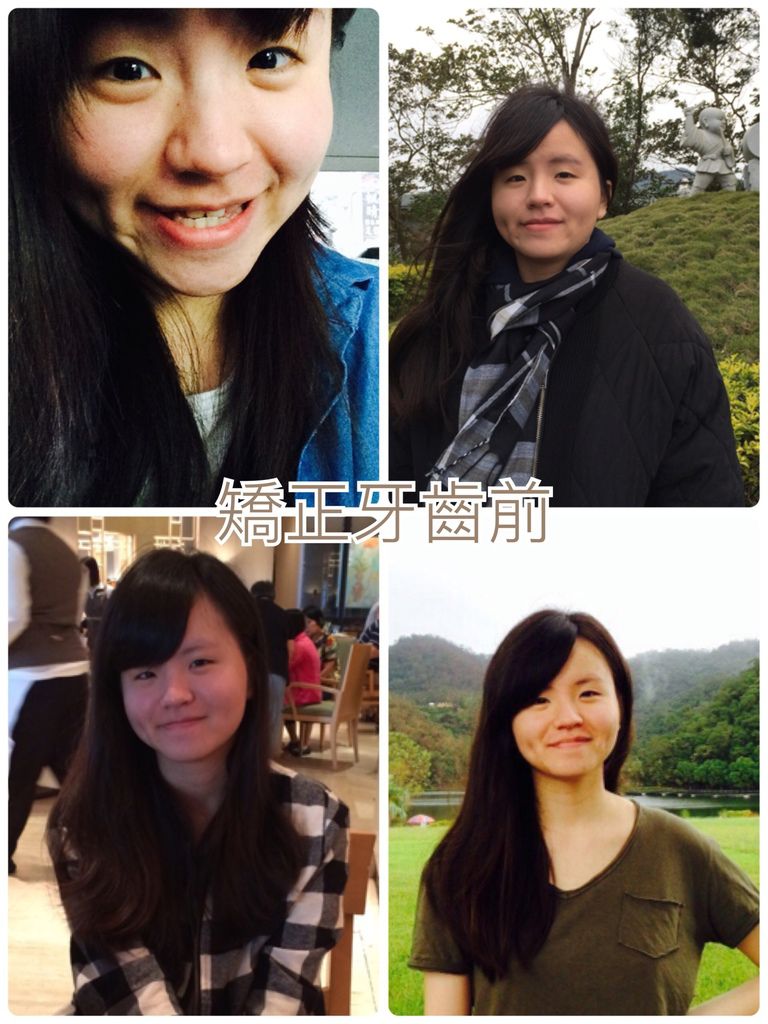 唐子婷提供照片befor.jpg 唐子婷提供照片befor.jpg