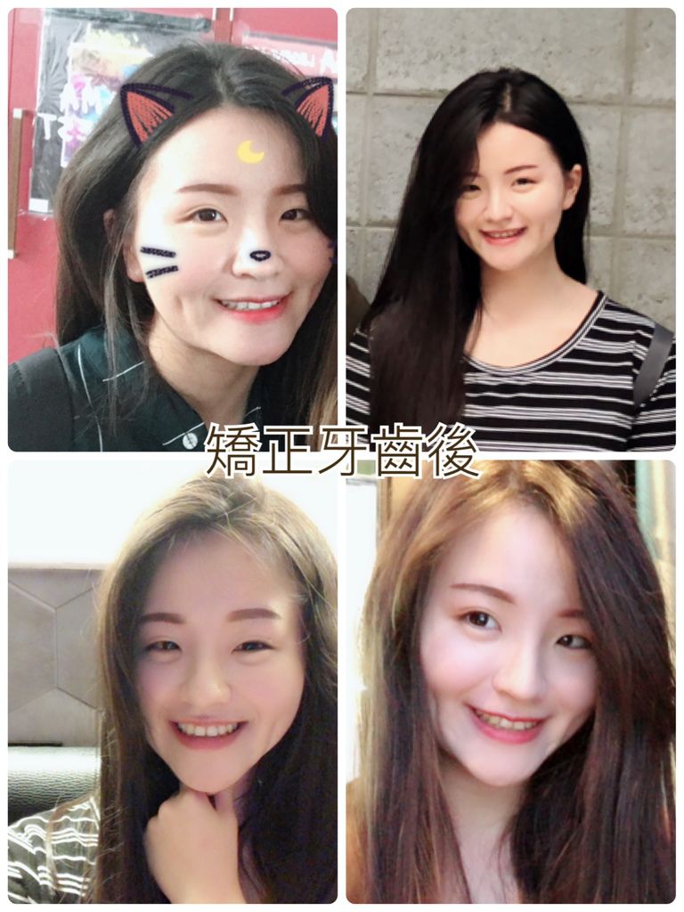 唐子婷提供照片after.jpg 唐子婷提供照片after.jpg