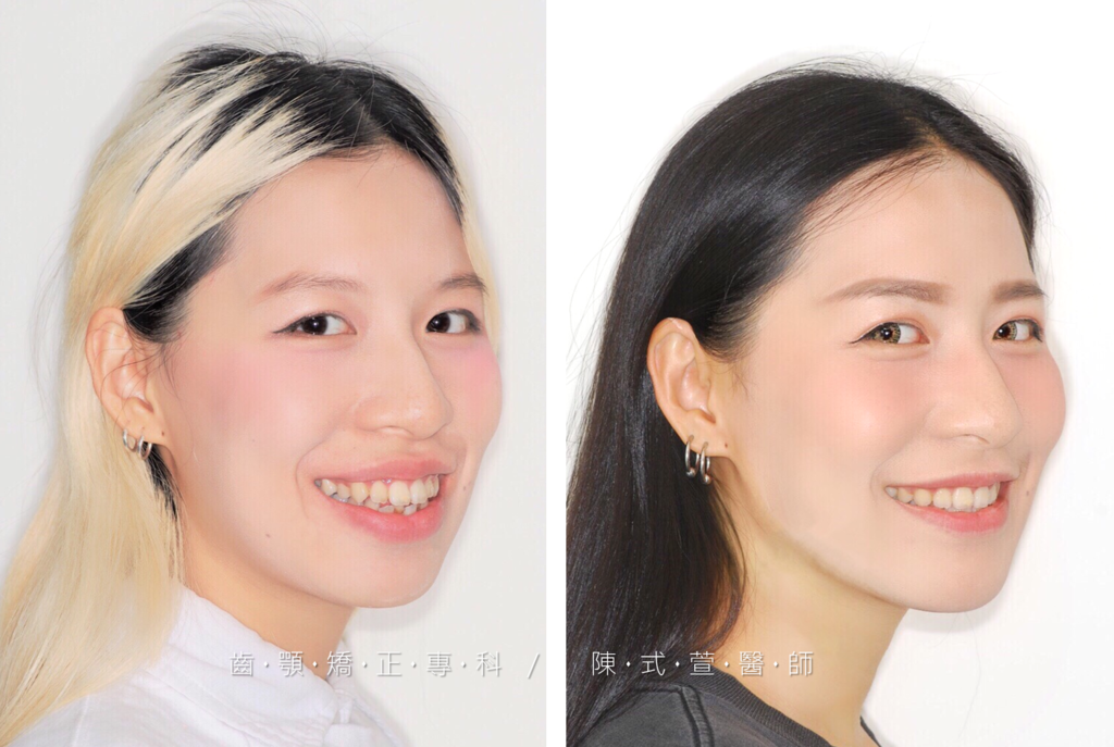 5 2.png 5 2.png