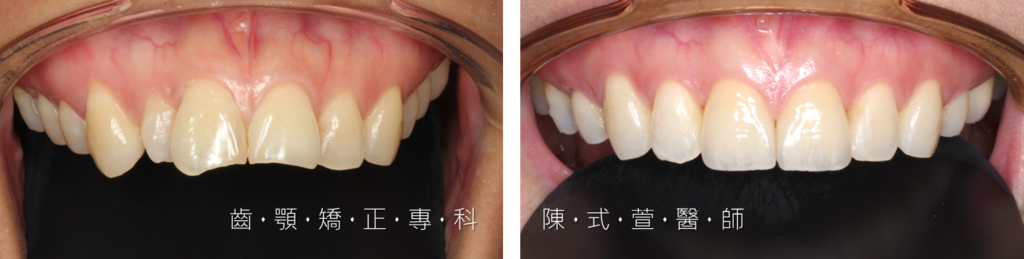 圖片4.png 圖片4.png