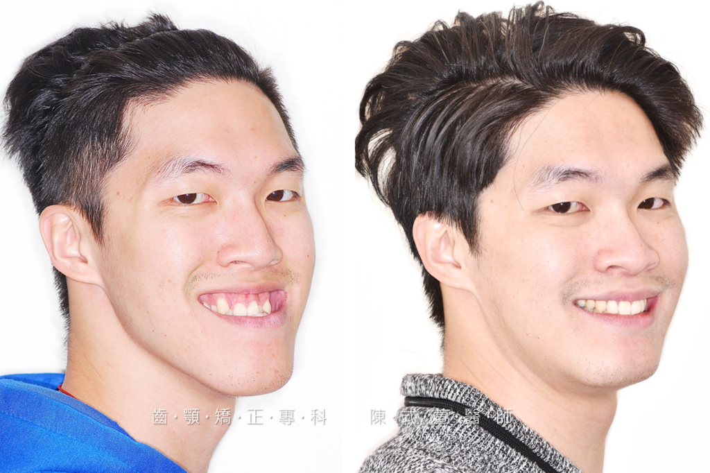 圖片11.png 圖片11.png