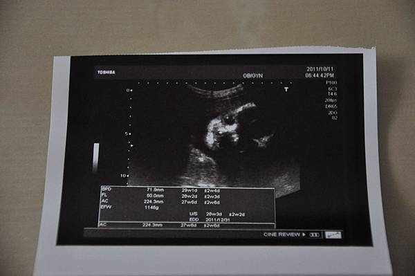 baby超音波 (27w)