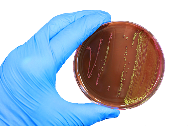 食品微生物檢驗為什麼很重要 微生物檢驗方法與法規