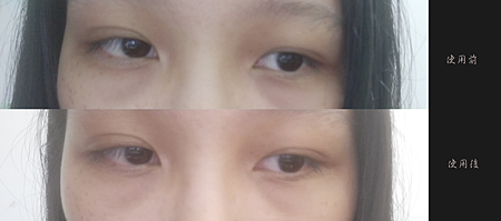IMG20181026234845凱拉帝卡 I’M FILL PATCH 玻尿酸微臻完美護理貼 試用