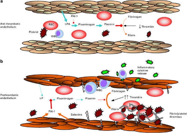 anti-thrombotic vs prothrombotic endothelium.jpg