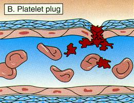 plateletplug.jpg