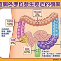 5個好習慣，有助遠離大腸癌