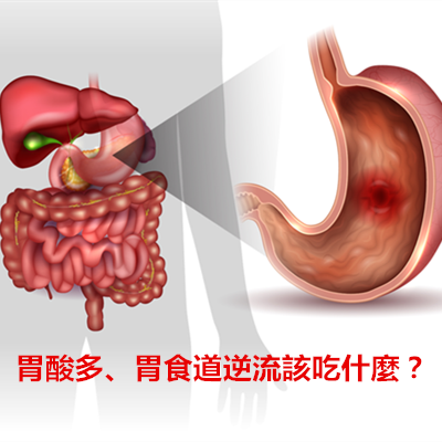 胃酸多、胃食道逆流該吃什麼?.png 胃酸多、胃食道逆流該吃什麼?.png