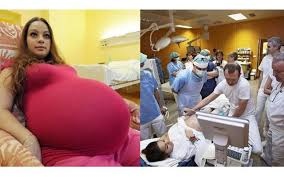女子以為自己懷了雙胞胎,去醫院檢查才知道,肚裡的數量破紀錄了,分娩過程僅5分鐘.jpg 女子以為自己懷了雙胞胎,去醫院檢查才知道,肚裡的數量破紀錄了,分娩過程僅5分鐘.jpg