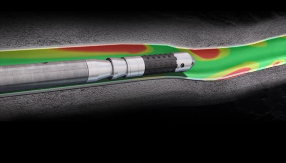 Dissolvable Frac Plugs: Enhanc