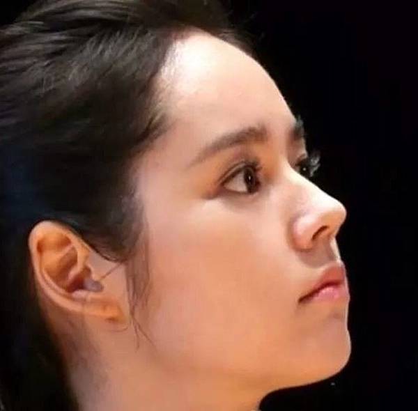 俏鼻不是韓式鼻翹！『鼻額弧線』會是另一個貼近東方特性的鼻線條