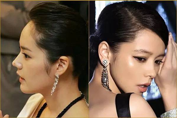 俏鼻不是韓式鼻翹！『鼻額弧線』會是另一個貼近東方特性的鼻線條