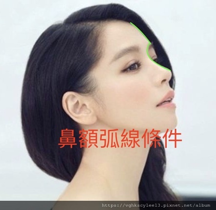 俏鼻不是韓式鼻翹！『鼻額弧線』會是另一個貼近東方特性的鼻線條