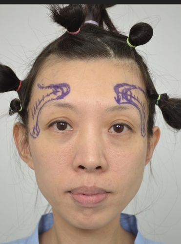 IMG_3479.jpg - 太陽穴