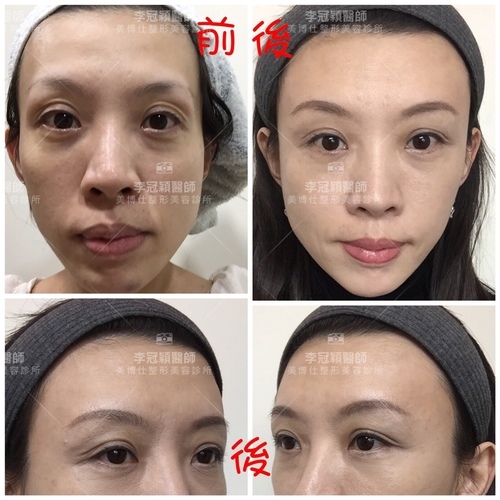 IMG_3502.JPG - 太陽穴