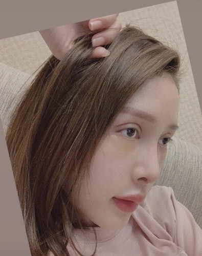 搶救隆鼻失敗(一)(二次重修鼻):隆鼻後反而要蓋劉海為什麼? fullsizeoutput_1de.jpeg - 鼻整形