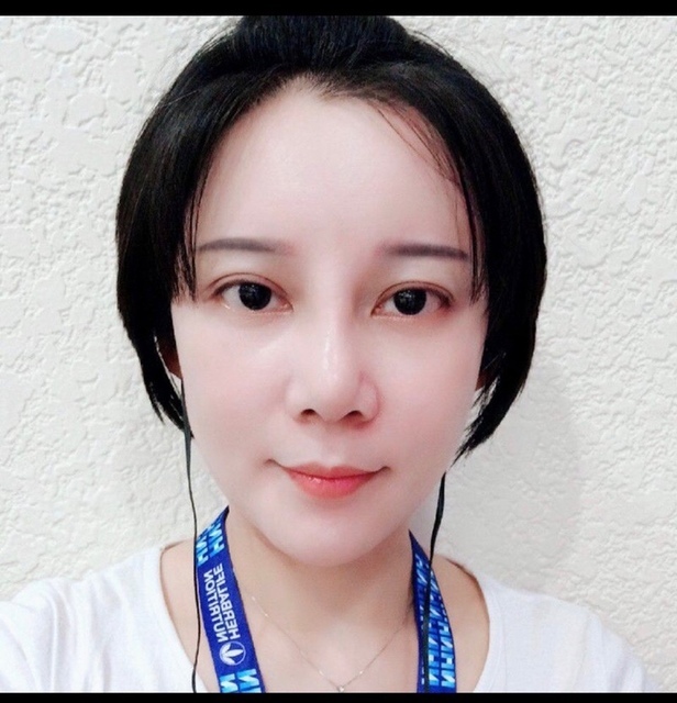 豐額／墊眉骨過渡期多久？傷口在哪裡？墊額頭會不會很腫跟瘀青？