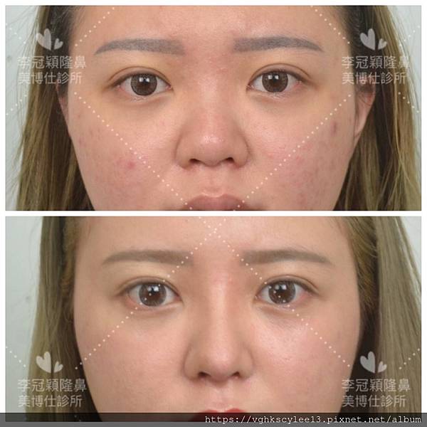 4C498F39-467F-4C8D-BAF1-F0221367C0F1(1).jpg 4C498F39-467F-4C8D-BAF1-F0221367C0F1(1).jpg