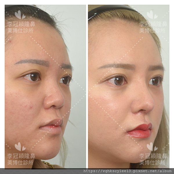 9DF926E7-CADA-4D56-BA9B-AF524D4A1BA2.jpg 9DF926E7-CADA-4D56-BA9B-AF524D4A1BA2.jpg