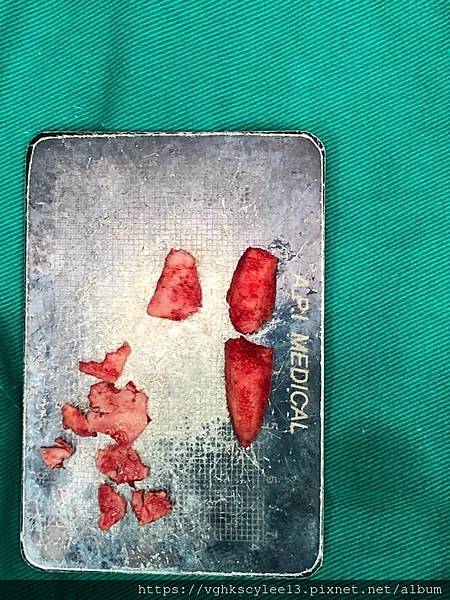 隆鼻價位多少?為什麼差異大!原因? 隆鼻價位多少?為什麼差異大!原因?