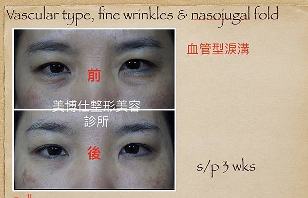 1191113504_o.jpg 1191113504_o.jpg