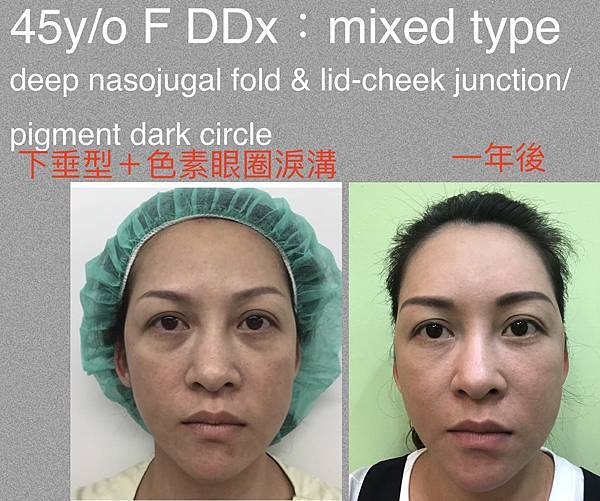 1191115071_o.jpg 1191115071_o.jpg